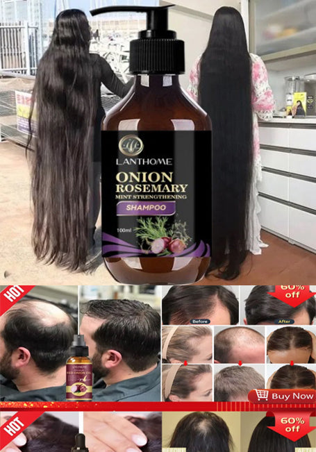 Hair growth serum, hair loss treatment, hair growth oil