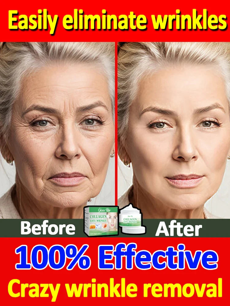 Anti Aging Wrinkle Remover