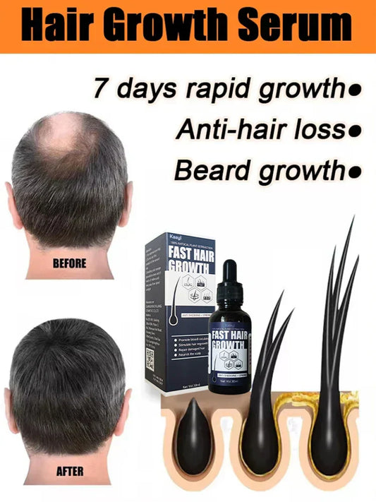 Hair Growth Oil Anti Hair Loss Fast Growing and Repair thick hair