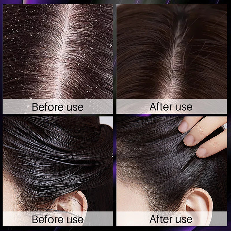 Hair Growth Thickening Shampoo Hair Growth Deep Cleansing Volumizing Shampoo Rosemary Onion Shampoo Care Product