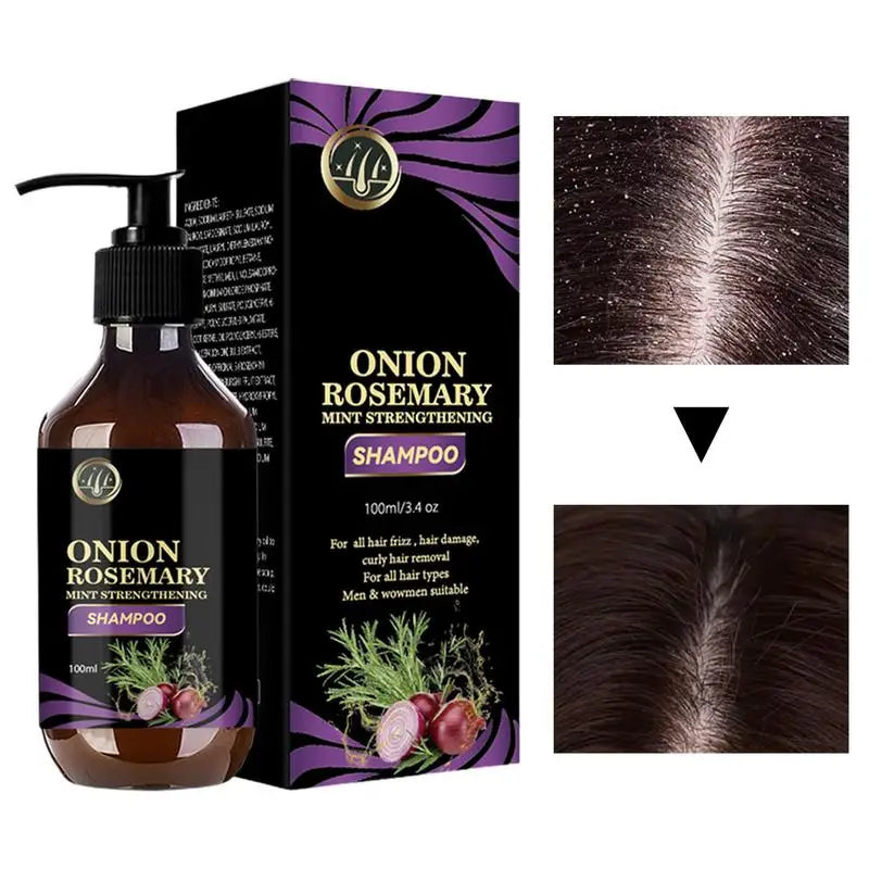 Hair Growth Thickening Shampoo Hair Growth Deep Cleansing Volumizing Shampoo Rosemary Onion Shampoo Care Product