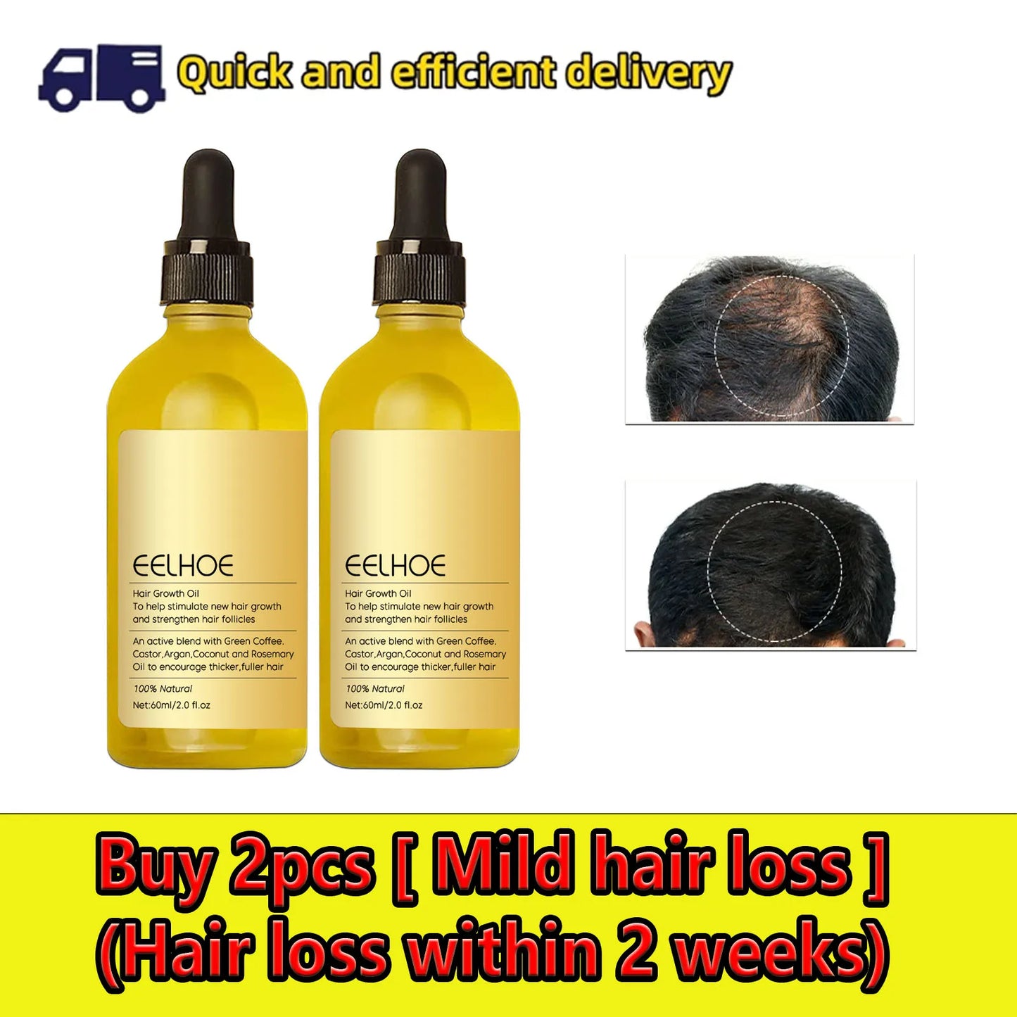 Hair Growth Products Prevent Hair Loss Essential Oil Fast Growing Anti-Drying Scalp Treatment Repair Beauty Health for Men Women