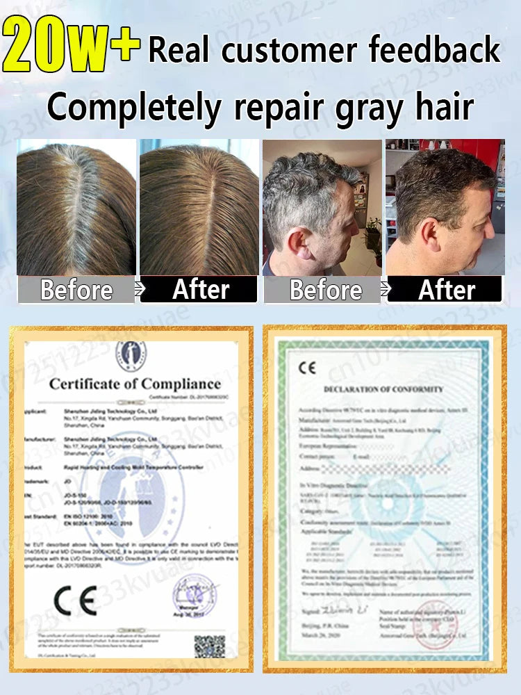 Nᴀᴛᴜʀᴀʟ Aɴᴛɪ-Gʀᴀʏ Hᴀɪʀ Sᴇʀᴜᴍ: Rᴇsᴛᴏʀᴇs Dᴀʀᴋ Hᴀɪʀ Cᴏʟᴏʀ & Pʀᴇᴠᴇɴᴛs Pʀᴇᴍᴀᴛᴜʀᴇ Gʀᴀʏɪɴɢ - Rᴇᴠɪᴛᴀʟɪᴢɪɴɢ Fᴏʀᴍᴜʟᴀ