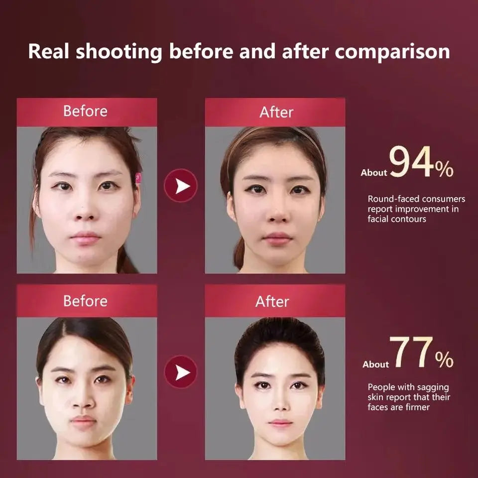 Facial Lifting Device LED Photon Therapy Facial Slimming Vibration Massager Heated Double Chin V Face Massager