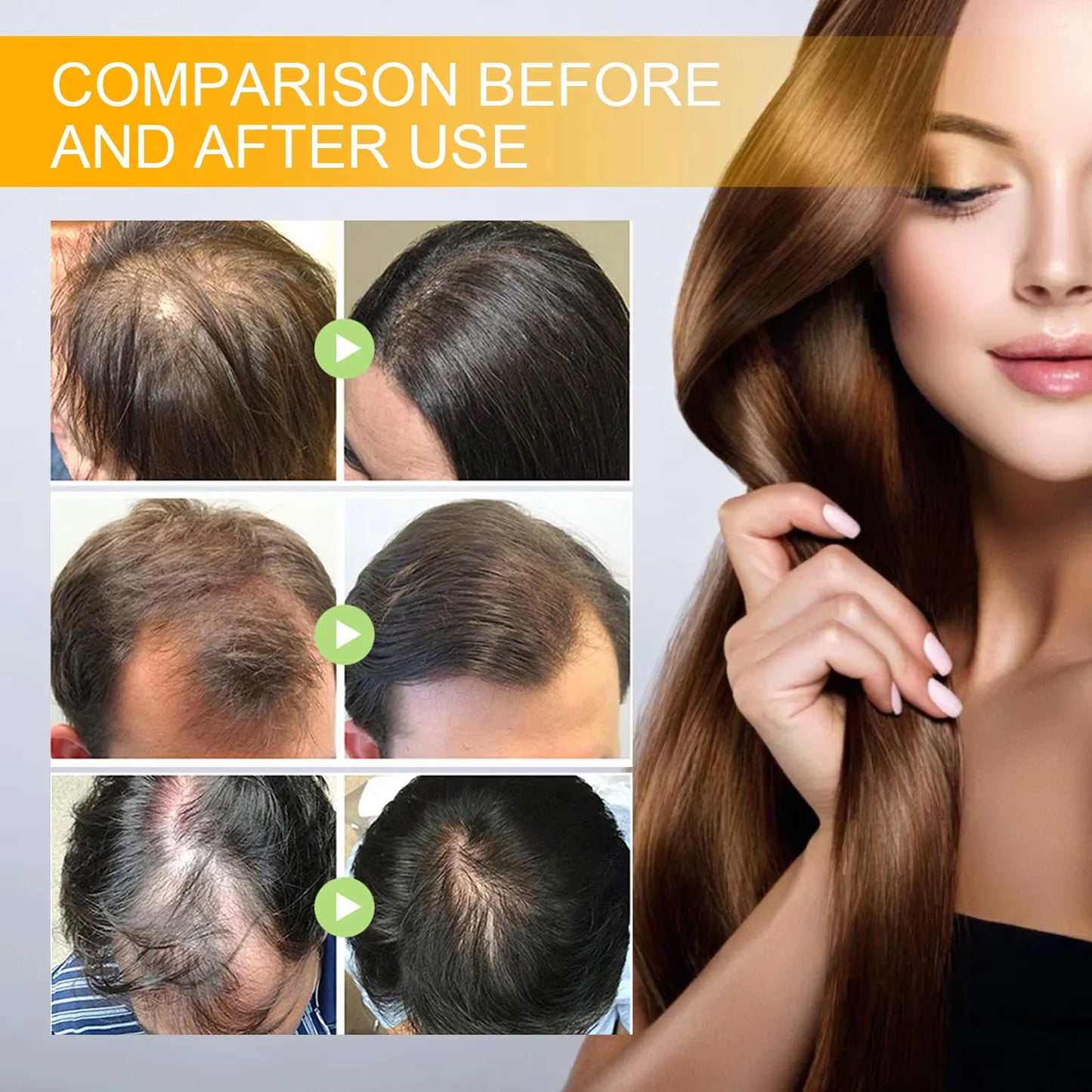 Biotin Fast Hair Growth Products Anti Hair Loss Serum Spray Prevent Baldness Treatment Scalp Beard Beauty Hair Care Product